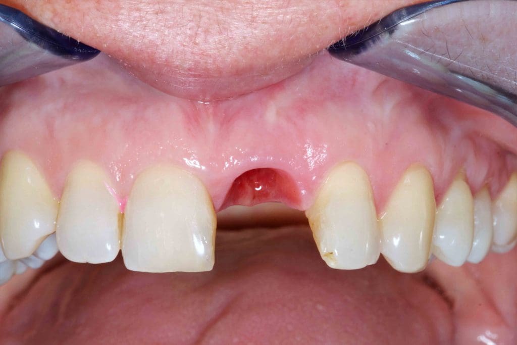 Before image