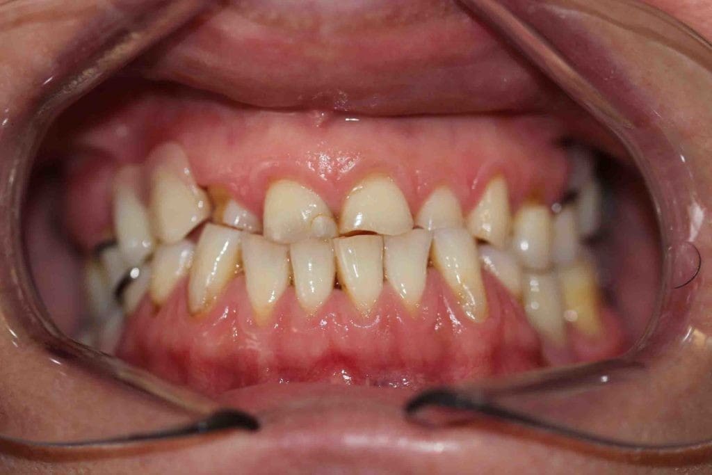 Before image
