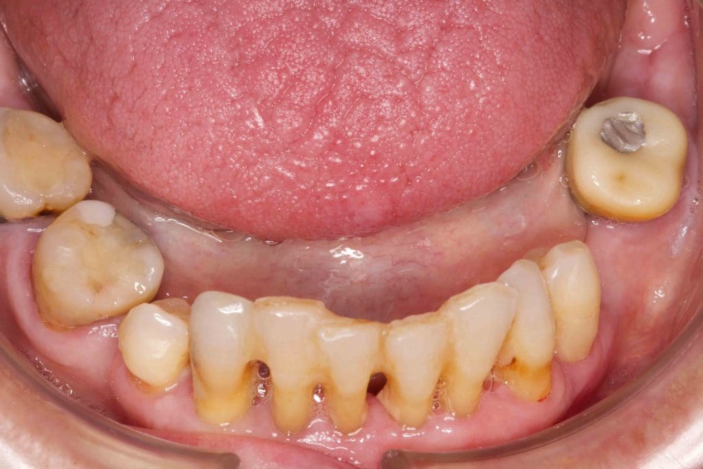 Before image