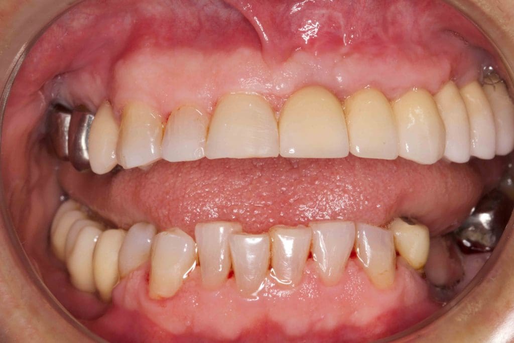 After image