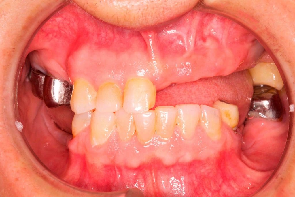 Before image