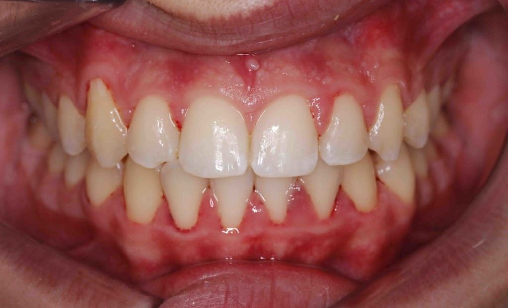 After image