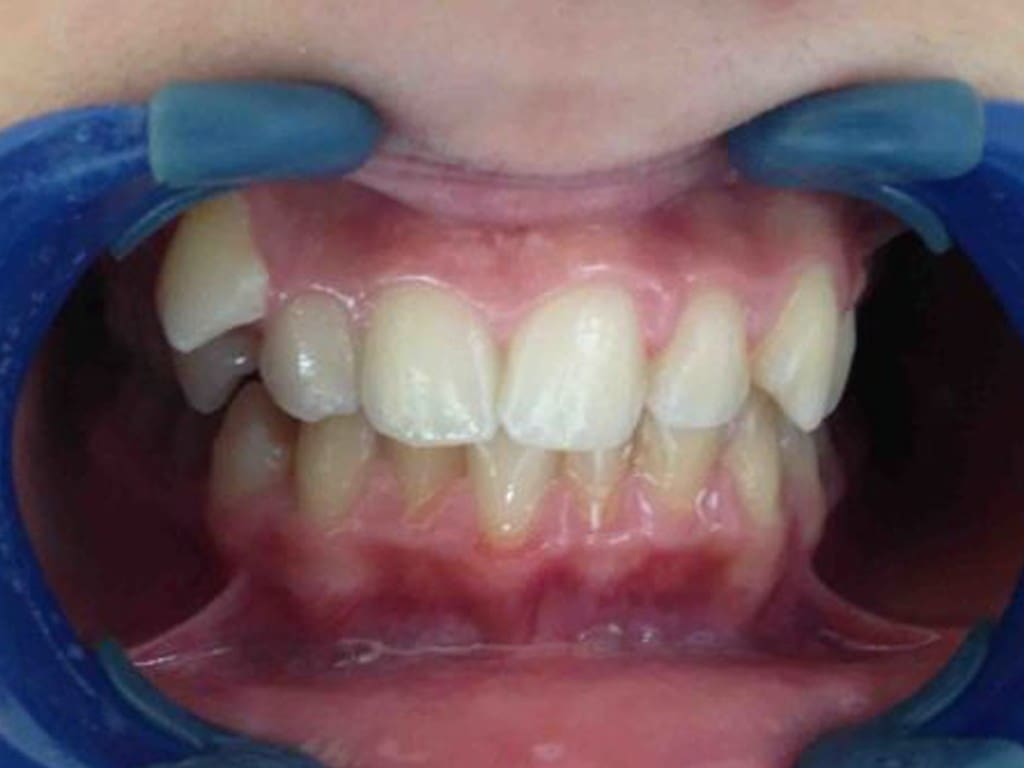 Before image