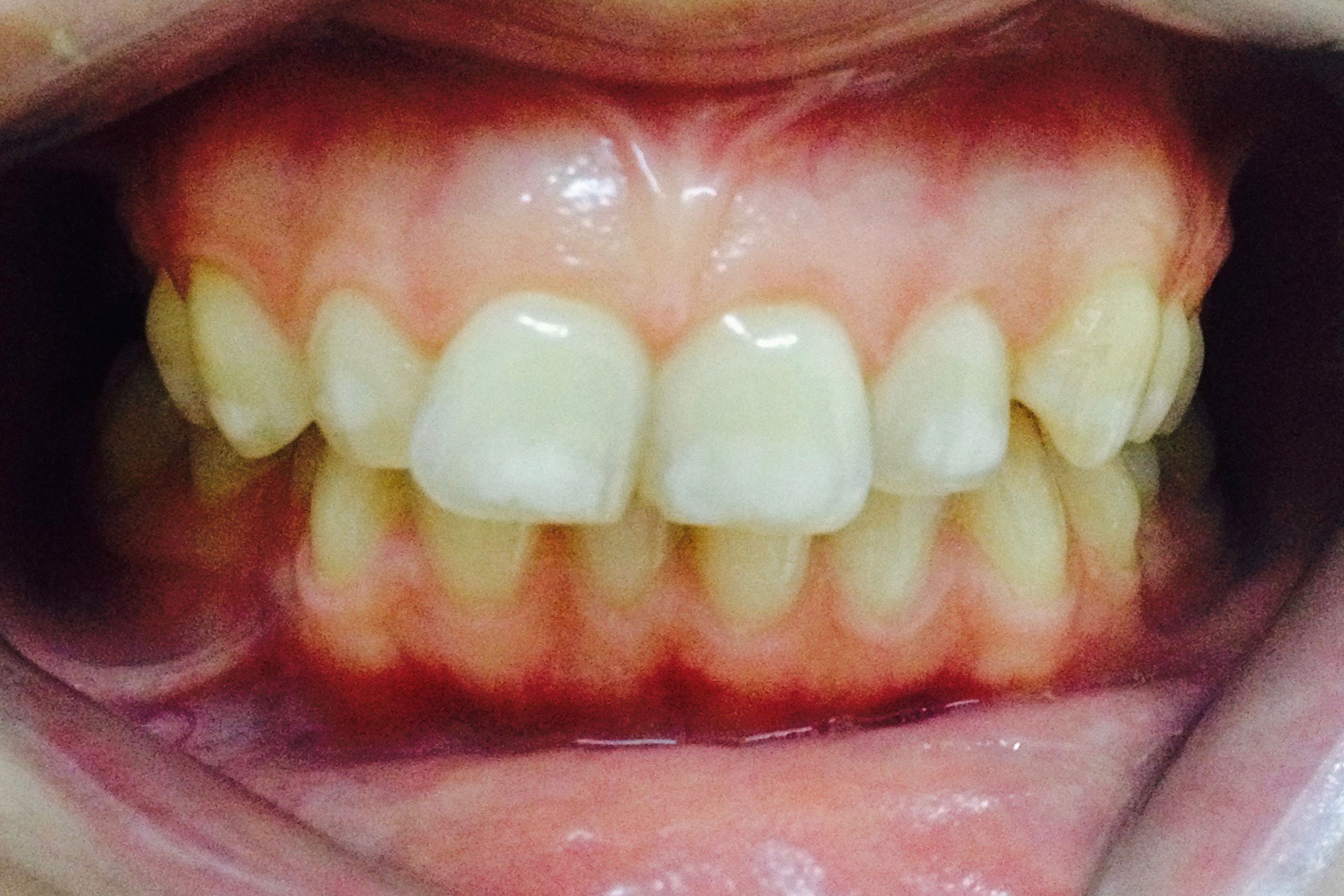 Before image