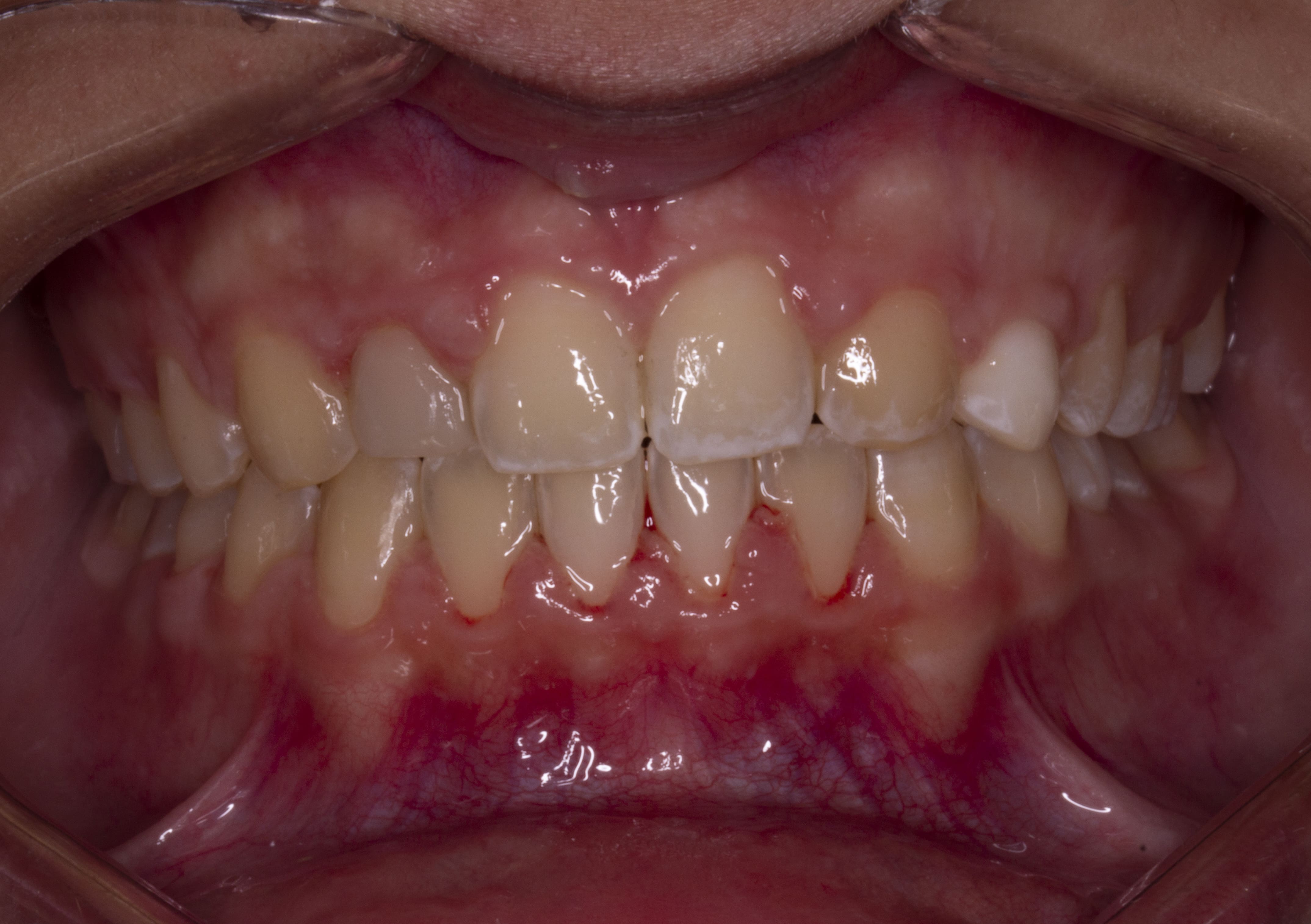 After image